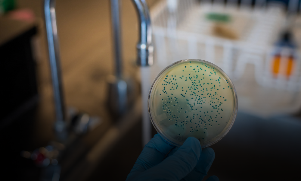 ¿Salmonella u otra infección? Por qué un diagnóstico rápido puede marcar la diferencia